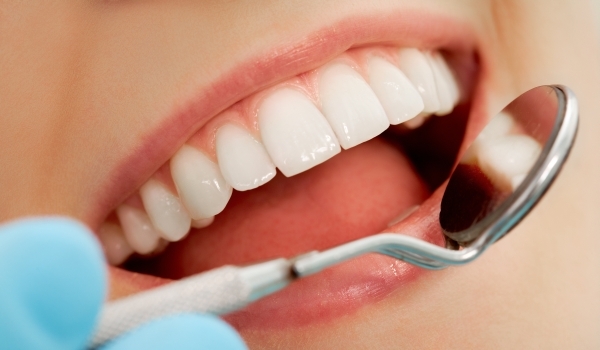 carii-dentare